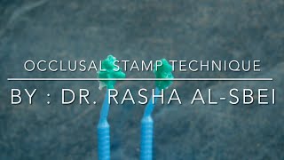 Occlusal Stamp Technique in 1 Minute  Clinical Case [upl. by Teragramyram]