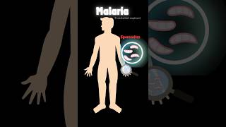 Malaria amp life cycle of plasmodium 🦟 neetbiology humanhealthanddisease neet pw viralshorts [upl. by Immak835]