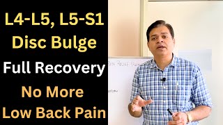 5 Steps For Disc Bulge Treatment Low Back Pain Full Recovery Herniated Disc Recovery Part1 [upl. by Farnham]