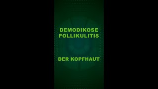 Demodikose Follikulitis der Kopfhaut [upl. by Leugim]