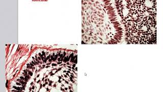 Odontogenic Tumors [upl. by Dorcus34]