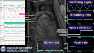 Noncontact Sleep Monitoring Somnography Using an IR UWB Radar Sensor August 2016 [upl. by Notnil151]