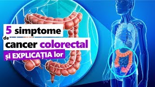 5 SIMPTOME EXPLICATE Cancer de Colon  Colorectal [upl. by Ardnuasak870]