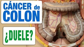 Cáncer de Colon y Dolor [upl. by Lenod515]