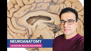 NEUROANATOMY CADAVERIC IMAGES DISCUSSION [upl. by Yhotmit]