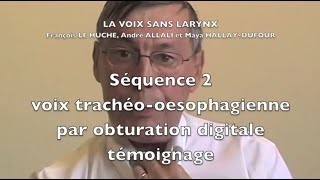 La voix sans larynx Séquence 2 Voix trachéo oesophagienne [upl. by Asante336]