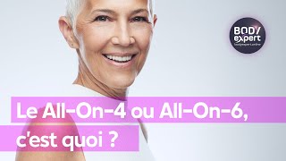 SOINS DENTAIRES  🦷Le AllOn4 ou AllOn6 c’est quoi  BODYEXPERT [upl. by Atat]