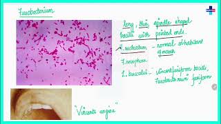 Non sporing anaerobic bacteria ll Free Microbiology Chapterwise lectures ll [upl. by Nader]