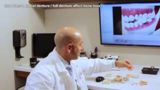 How does a denture affect bone loss  Daniel Daniel Dentistry [upl. by Zetnom907]