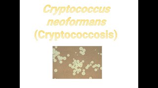 Cryptococcus neoformans I Cryptococcosis I Medical mycosis I Medical microbiology I [upl. by Artema]