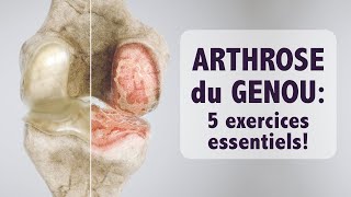 Arthrose du genou 5 exercices ESSENTIELS [upl. by Adrianna260]