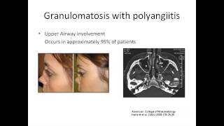 ANCA Vasculitis A Rheumatologists Perspective by Padmapriya Sivaraman MD [upl. by Letnuahs]