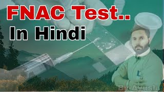 FNAC Test Results Normal Range Cost  यदि आपके शरीर में भी कोई गांठ है तो जरूर कराएं। [upl. by Amahs]