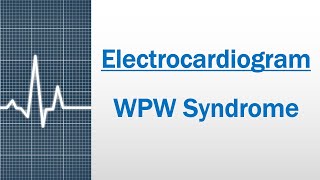 WPW syndrome Electrocardiogram [upl. by Drofdarb]