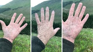 Giant Swarm Of Midges Stick To Hand In Scotland [upl. by Dranal195]