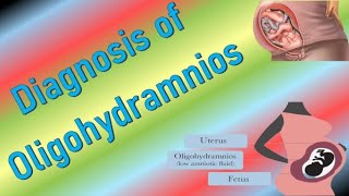 Diagnosis of Oligohydramnios by Ultrasound in Pregnancy [upl. by Bysshe]