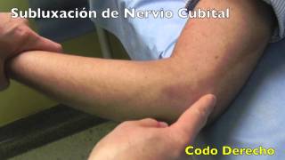 VIDEO ORTHOFERNX LUXACION DE NERVIO CUBITAL EN CODO [upl. by Naaitsirhc]