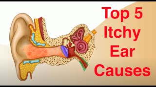 Top 5 Causes of Itchy Ears and Treatment Too [upl. by Neeham]