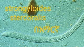 strongyloides stercoralis in Amharic language unit two medical parasitology [upl. by Refinnaj]