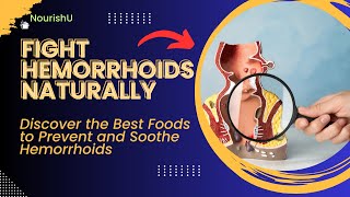 Haemorrhoid Healing Top Foods to Include in Your Diet [upl. by Hayyikaz]