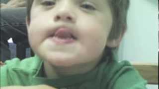 Dariens Journey with Childhood Apraxia of Speech [upl. by Mchail279]