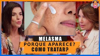 A Melhor explicação sobre Mancha no Rosto de MELASMA como aparece e como tratar [upl. by Ameehsat]