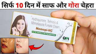 Memopi HC Cream Review 2024  memopi hc cream kaise use kare [upl. by Nref]