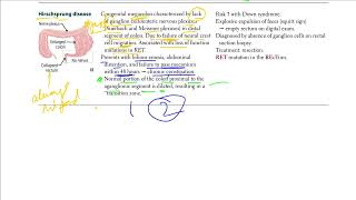 Hirschsprung Disease  USMLE STEP 1 [upl. by Trever796]