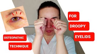 One easy OSTEOPATHIC technique for DROOPY EYELIDS [upl. by Susanne]