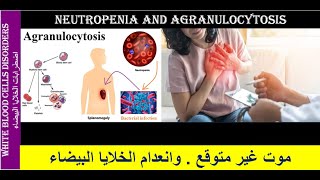 Lecture 23 Neutropenia and Agranulocytosis [upl. by Feilak]