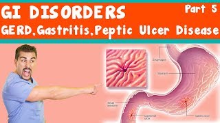 GI Disorders GERD Gastritis peptic ulcer Disease Part 5 [upl. by Flosi]