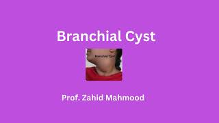 Branchial Cyst by Prof Zahid Mahmood [upl. by Ocirrej]