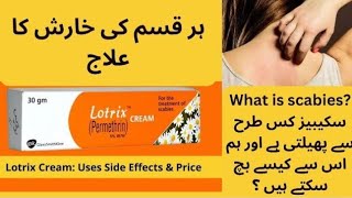 Lotrix cream  Perminthin  Use for Scabies  Treatment  Cream Side effects in Urdu Hindi [upl. by Lachlan]