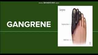 Gangrene Dry Wet and Gas Gangrene [upl. by Kcirded]