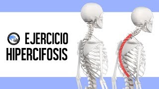 Ejercicio para la hipercifosis dorsal joroba o chepa [upl. by Aleit]