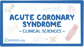 Acute coronary syndrome Clinical sciences [upl. by Piderit]