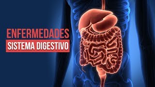 10 ENFERMEDADES DEL SISTEMA DIGESTIVO MÁS COMUNES 😷 ¡CUIDADO CON LA 7 [upl. by Tehr362]