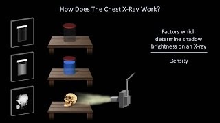 How to Interpret a Chest XRay Lesson 1  An Introduction [upl. by Latsyk]