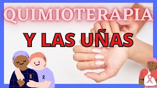 QUIMIOTERAPIA Y UÑAS [upl. by Hsoj328]