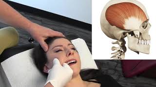 Temporal Headaches  Temporalis Muscle Internal Release Procedure  MSR Demo [upl. by Trauner]