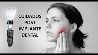 QUÉ CUIDADOS DEBES TENER LUEGO DE COLOCARTE UN IMPLANTE DENTAL [upl. by Ekard867]