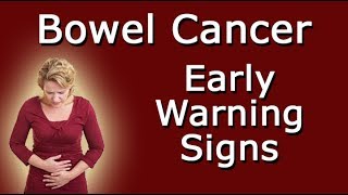 Early Warning Signs Of Bowel Cancer [upl. by Srednas]