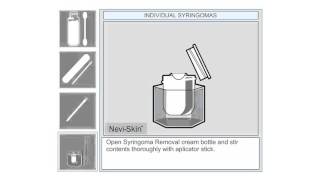 Individual Syringoma Removal at Home [upl. by Nyrraf]