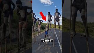 Kenapa mereka berjalan menggunakan tongkat‼️😱 [upl. by Annahsit43]