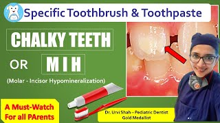 Chalky teeth Toothbrush amp Toothpaste for Chalky teeth or MIH [upl. by Annahsit]