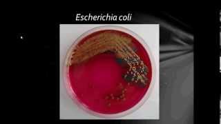 Bacteriology Gram Negative Bacilli Part1 [upl. by Airual363]