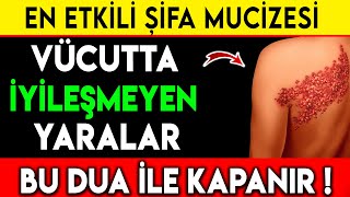 EN ETKİLİ ŞİFA DUASI VÜCUTTA İYİLEŞMEYEN YARALAR BU DUA İLE KAPANIR [upl. by Klotz]