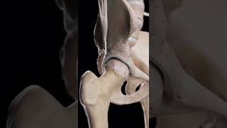 Hip Arthrosis When the Hip Joint Wears Down 🦴📚🥼 medical doctor ortho bone shortvideo video [upl. by Akenal]