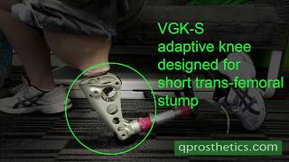 VGKS knee for short transfemoral stump [upl. by Bauer]