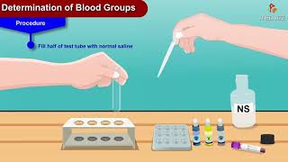 Determination of blood groups animation  Physiology practicals [upl. by Adnav]